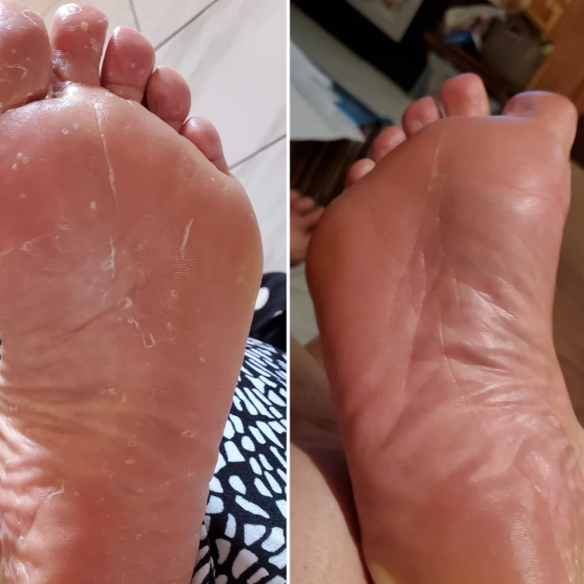 Sebriva Antifungal Soap®